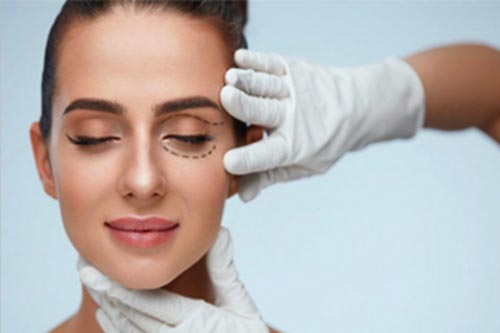 Blefaroplastia 1