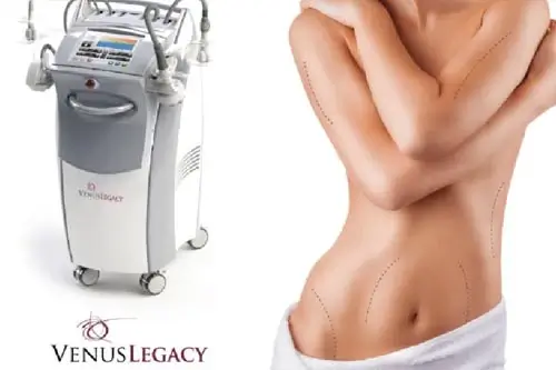 Venus Legacy RF 2