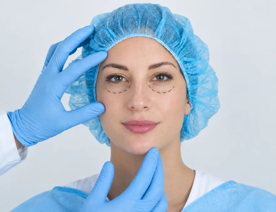 Blefaroplastia