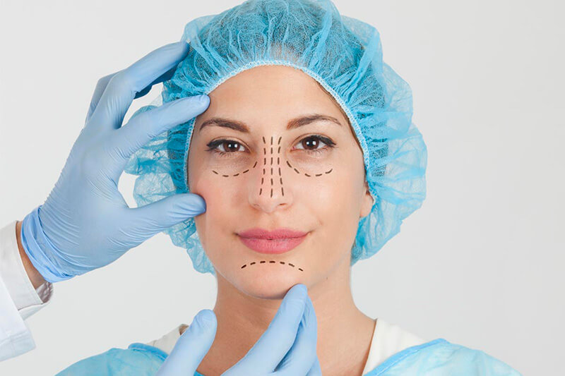 Blefaroplastia
