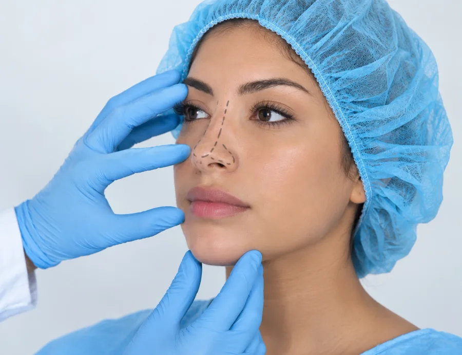 Rinoplastia